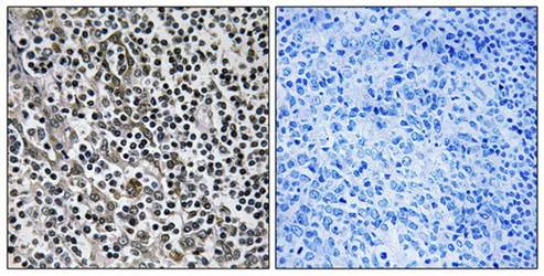 MRPL51 Antibody