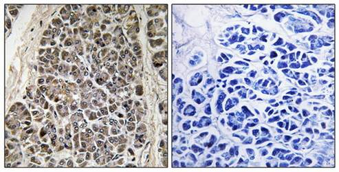 MRPS21 Antibody