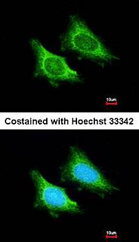 MRPS5 antibody
