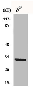 MS4A1 Antibody