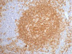 MS4A1 Antibody