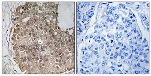 PARP4 Antibody