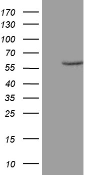 MSH6 Antibody