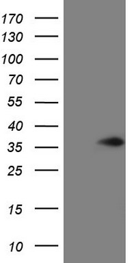 MSH6 Antibody