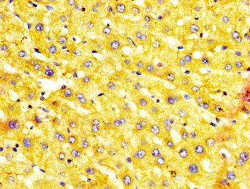 MST1 Antibody
