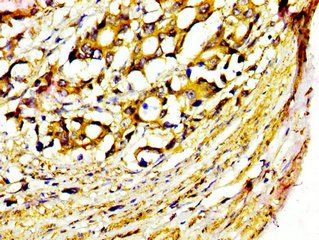 MST1 Antibody