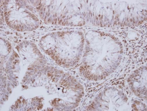 serine/threonine kinase 24 Antibody