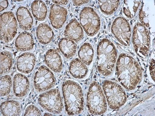MST4 Rabbit Polyclonal Antibody