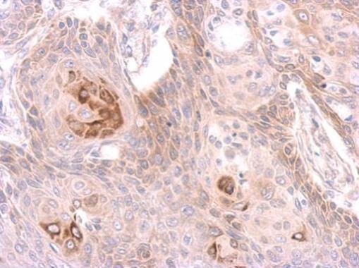 MST4 Rabbit Polyclonal Antibody