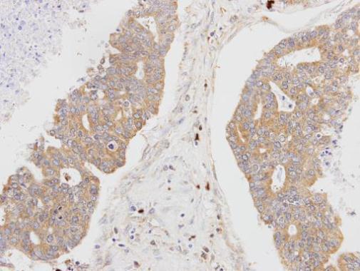 MSTO1 Rabbit Polyclonal Antibody