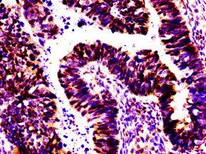MSX2 Antibody