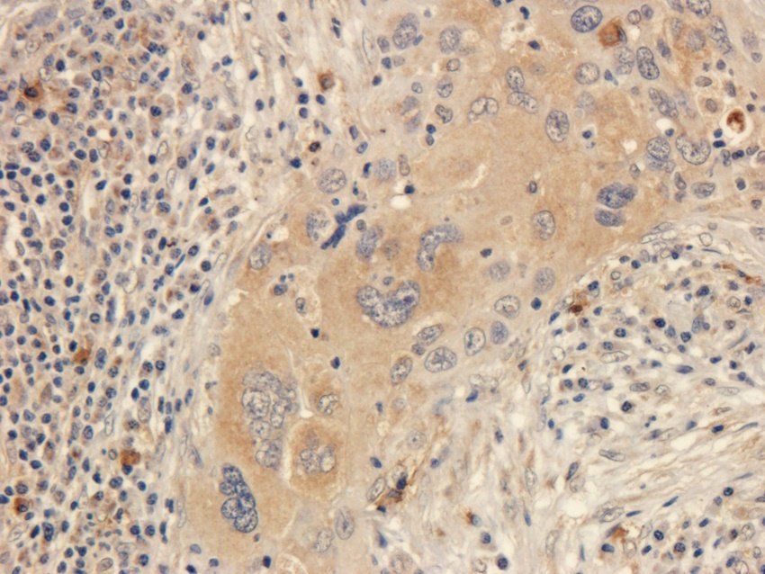 MT-ATP8 Rabbit Polyclonal Antibody