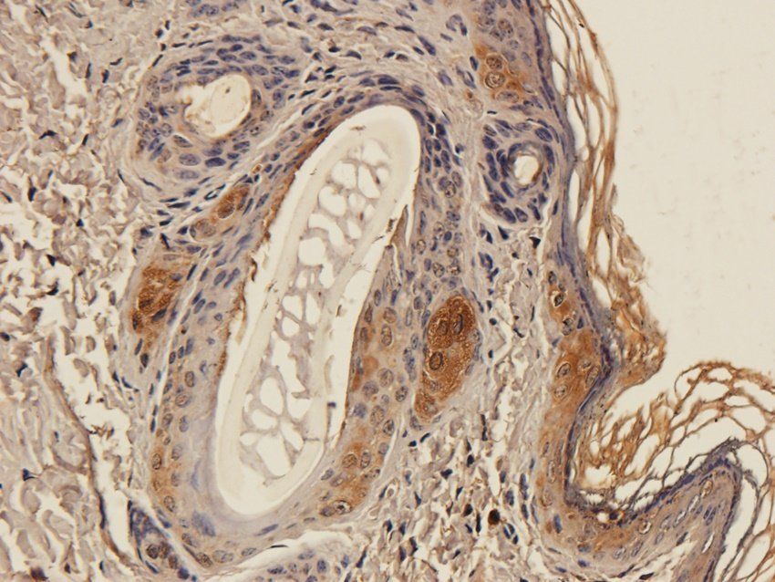 MT-ATP8 Rabbit Polyclonal Antibody