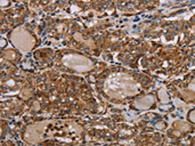 MT-ND6 Antibody