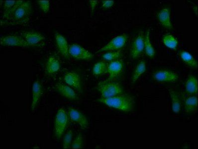 MT3 Antibody