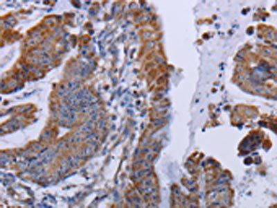 MT3 Antibody