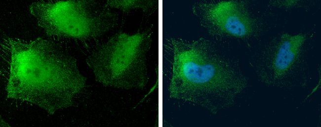MTAP Rabbit Polyclonal Antibody