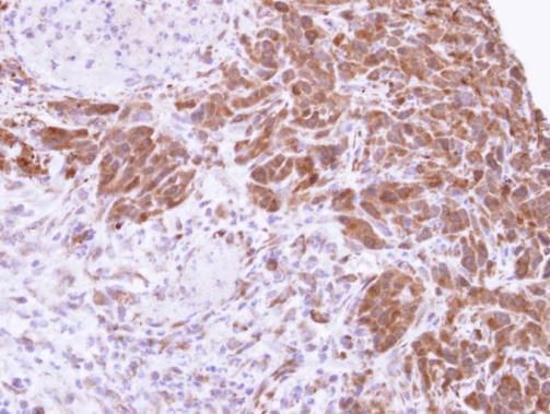 MTAP Rabbit Polyclonal Antibody
