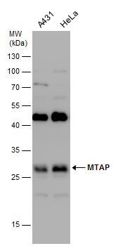 MTAP Rabbit Polyclonal Antibody