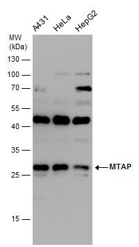 MTAP Rabbit Polyclonal Antibody
