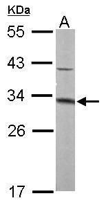 MTAP Rabbit Polyclonal Antibody