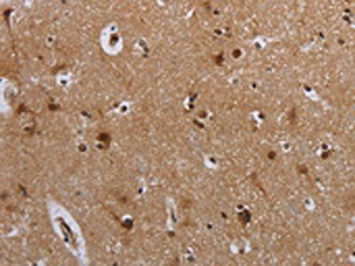 MTBP Antibody