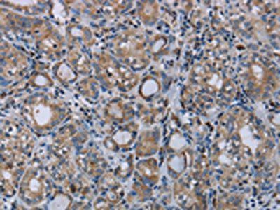MTBP Antibody
