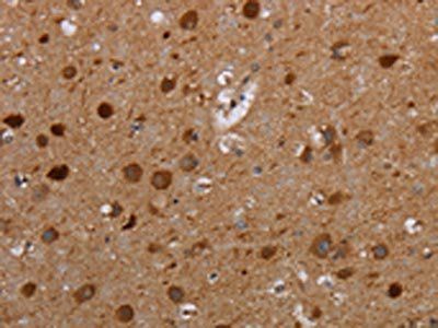 MTBP Antibody