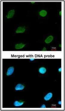 MTGR1 Rabbit Polyclonal Antibody