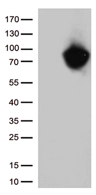 MTHFR Antibody