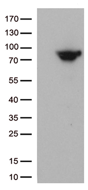 MTHFR Antibody