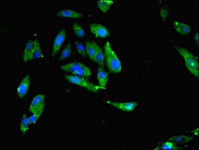 MTHFR Antibody