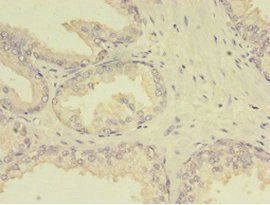 MTHFR Antibody