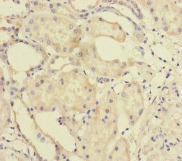 MTO1 Antibody
