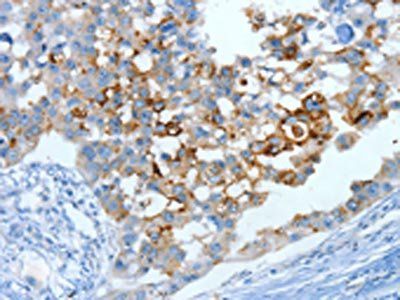 MUC15 Antibody