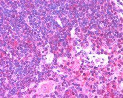 Munc13-4/UNC13D (Internal) Antibody
