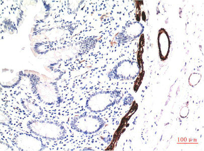 Muscle actin Antibody