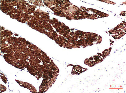 Muscle actin Antibody
