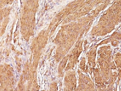 ACTA2 Antibody