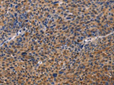 MUSK Antibody