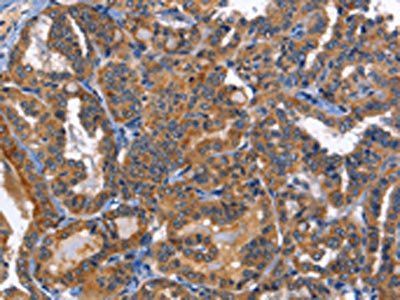 MUSK Antibody