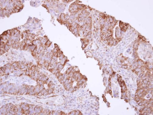 MX1 Rabbit Polyclonal Antibody