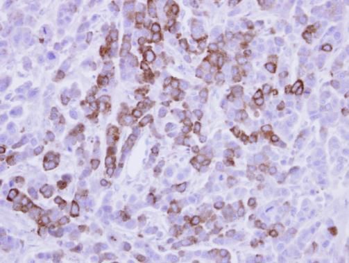 MX1 Rabbit Polyclonal Antibody