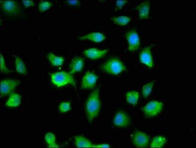 MYBPC1 Antibody