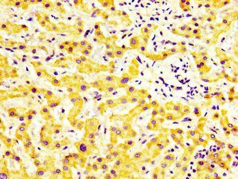 MYBPC1 Antibody