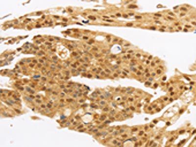 MYC Antibody