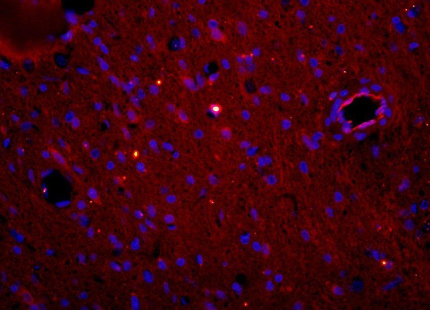 Myeloperoxidase Rabbit Polyclonal Antibody