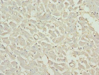 MB Antibody
