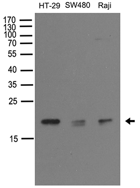 myosin light chain 1 Antibody