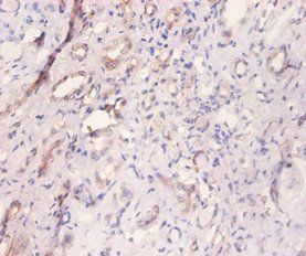 MYL6 Antibody